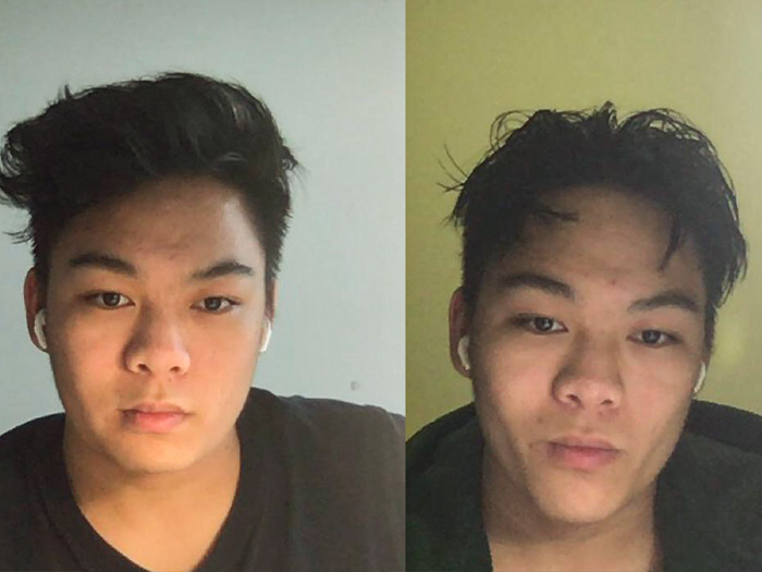 Mewing before and after results on an asian man